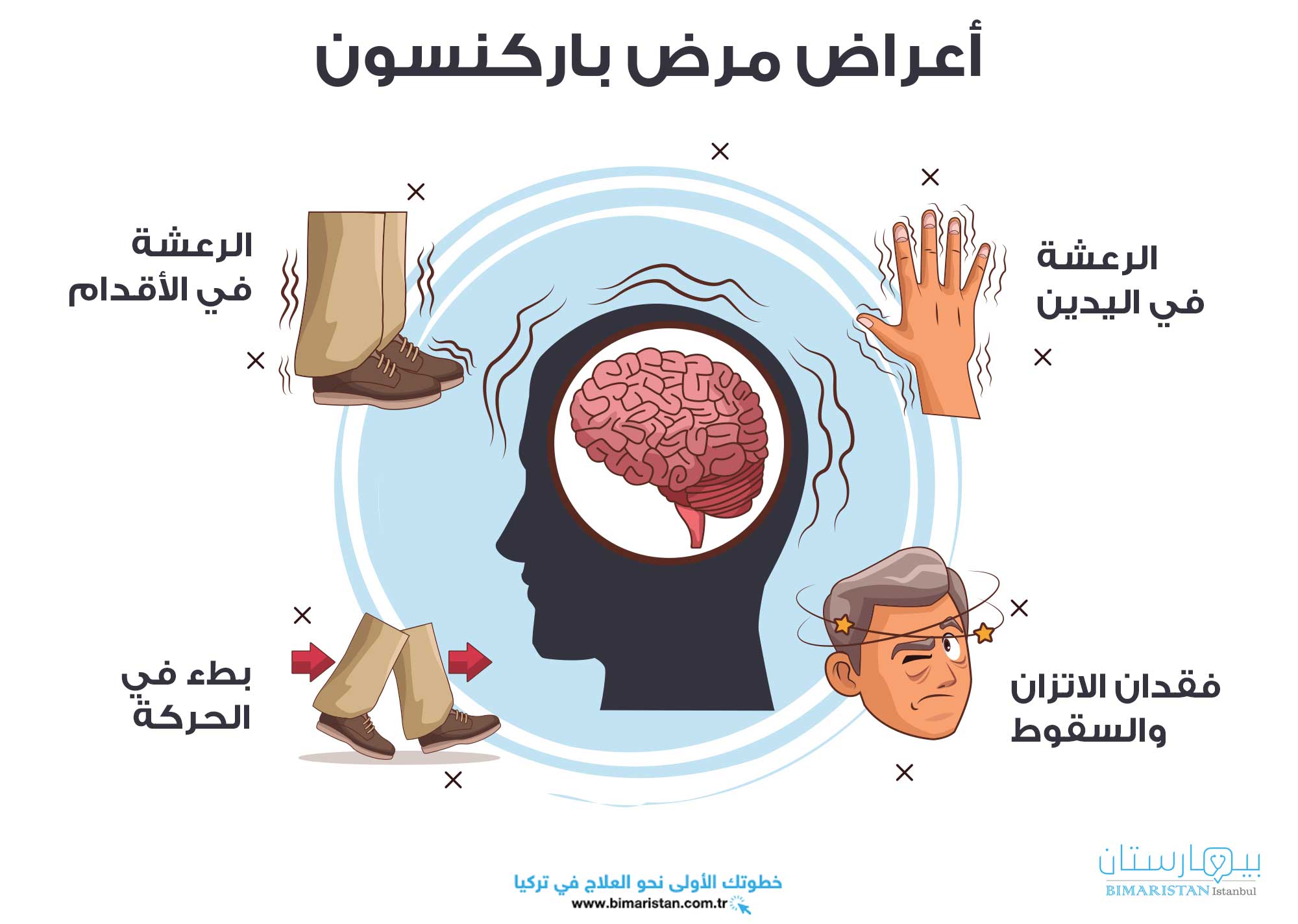 أعراض-مرض-باركنسون