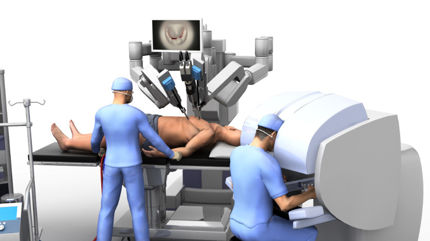 The shape of the robot used to robotically change the mitral valve of the heart