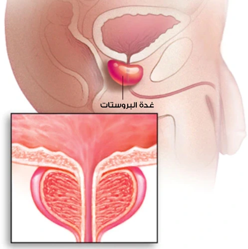 The normal position of the prostate gland