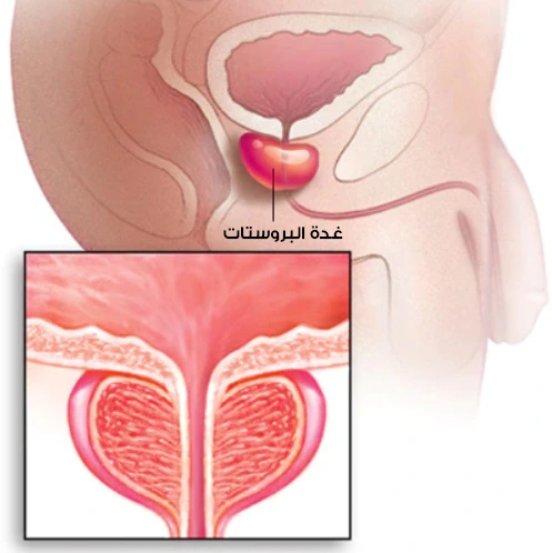 التوضع الطبيعي لغدة البروستاتا