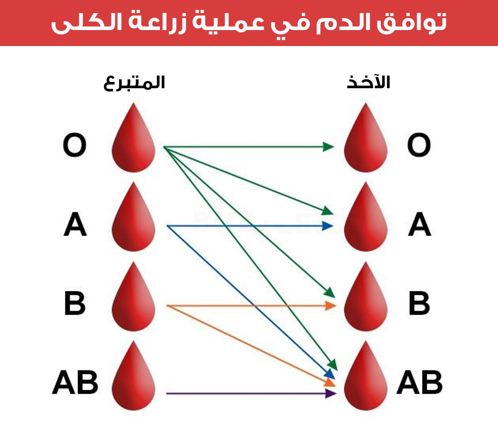 A picture showing the blood types, from which groups you take and which groups you give in a kidney transplant