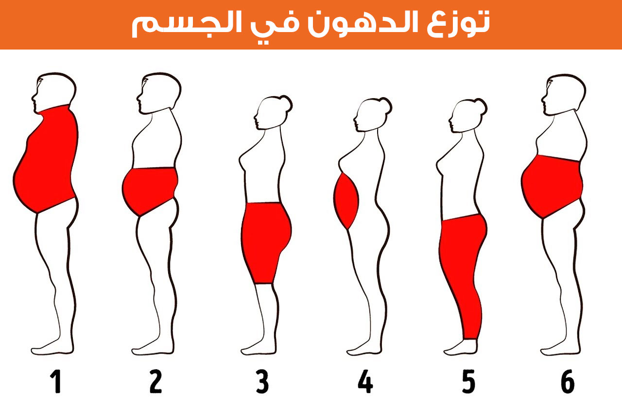 صورة توضح اختلاف نوع ومكان توزع الدهون في الجسم باختلاف الأشخاص