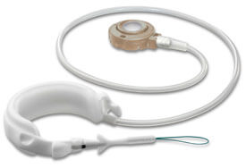 Gastric banding device used in laparoscopic gastric banding operations