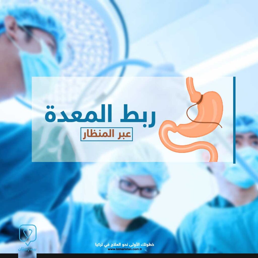 Türkiye'de laparoskopik gastrik bypass ameliyatı