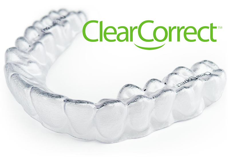 صورة لتقويم الأسنان الشفاف كليركوركت ClearCorrect الذي يستخدم عوضاً عن التقويم المعدني