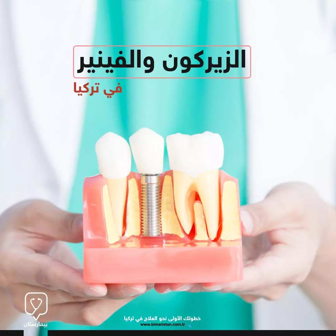 أنواع تلبيس الأسنان