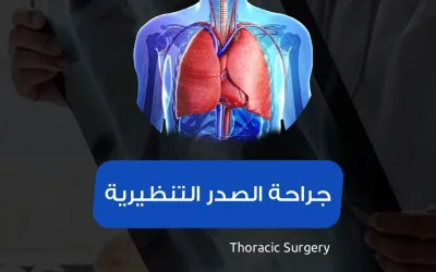 جراحة الصدر في تركيا