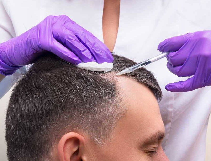 Plasma injection into the scalp 