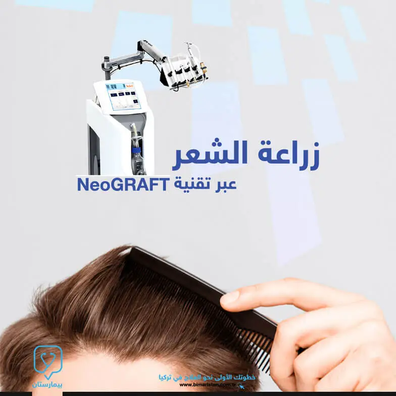 زراعة الشعر بجهاز NeoGraft