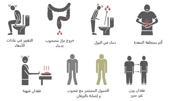 العلامات الشائعة للإصابة بسرطان القولون والمستقيم