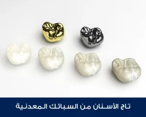 Dental crown made of metal alloys