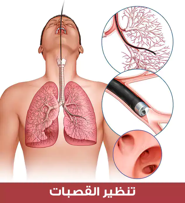 Bronchoscopy, which is useful in diagnosing disorders of the windpipe (trachea)