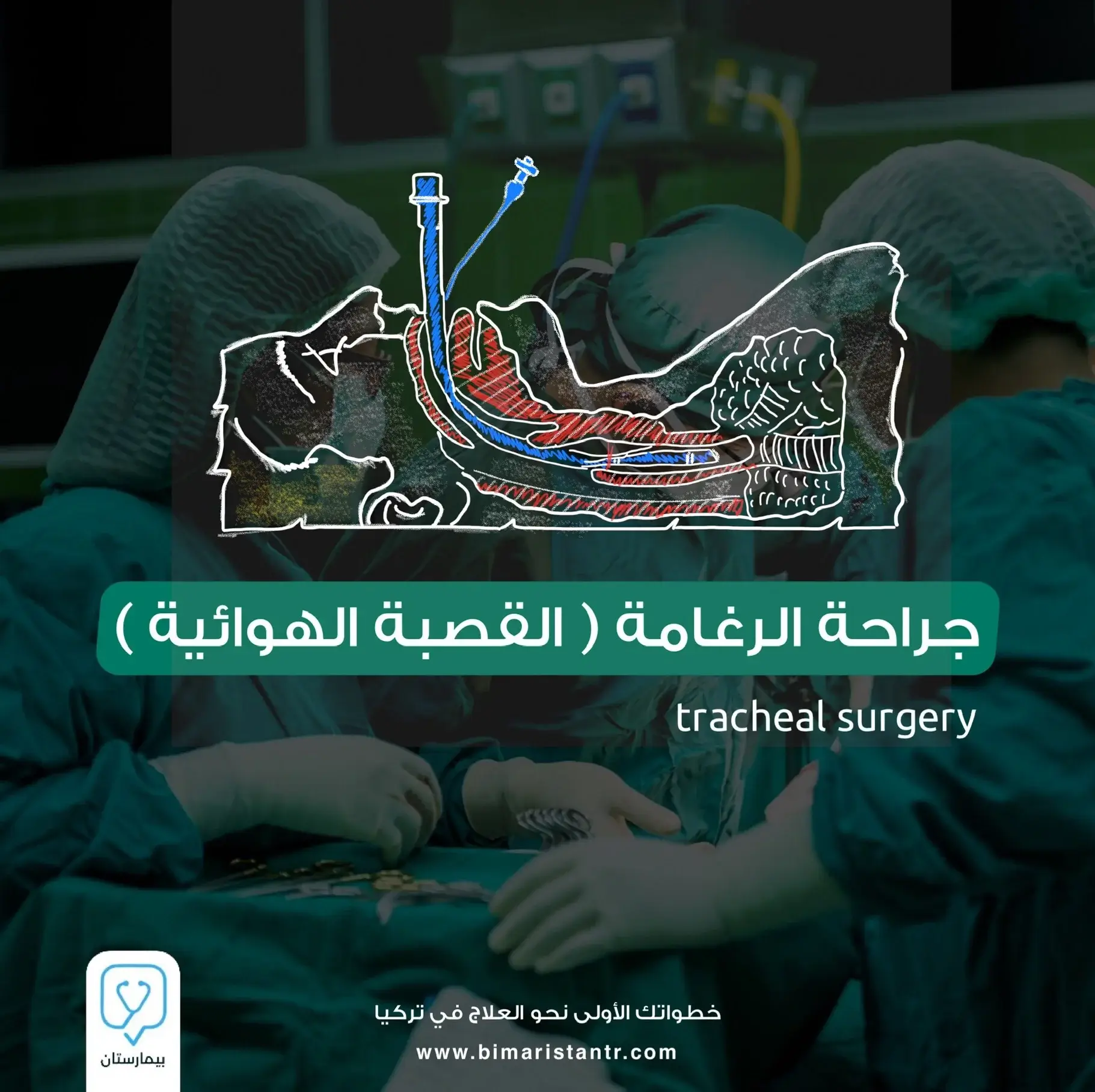 Endotracheal surgery in Turkey