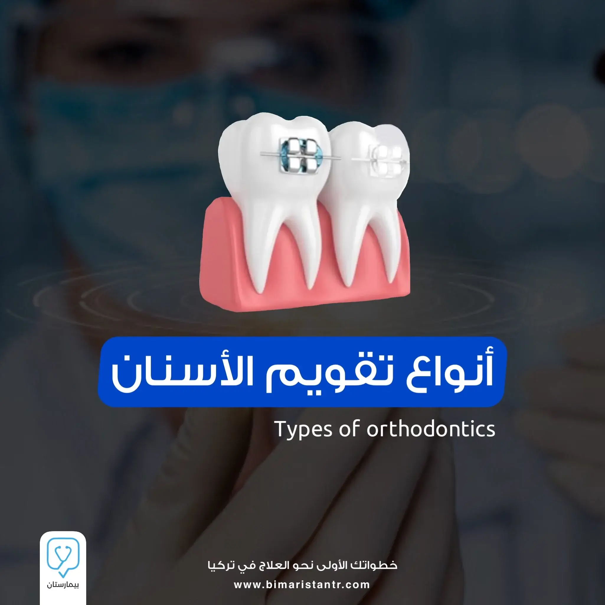 Types of orthodontics
