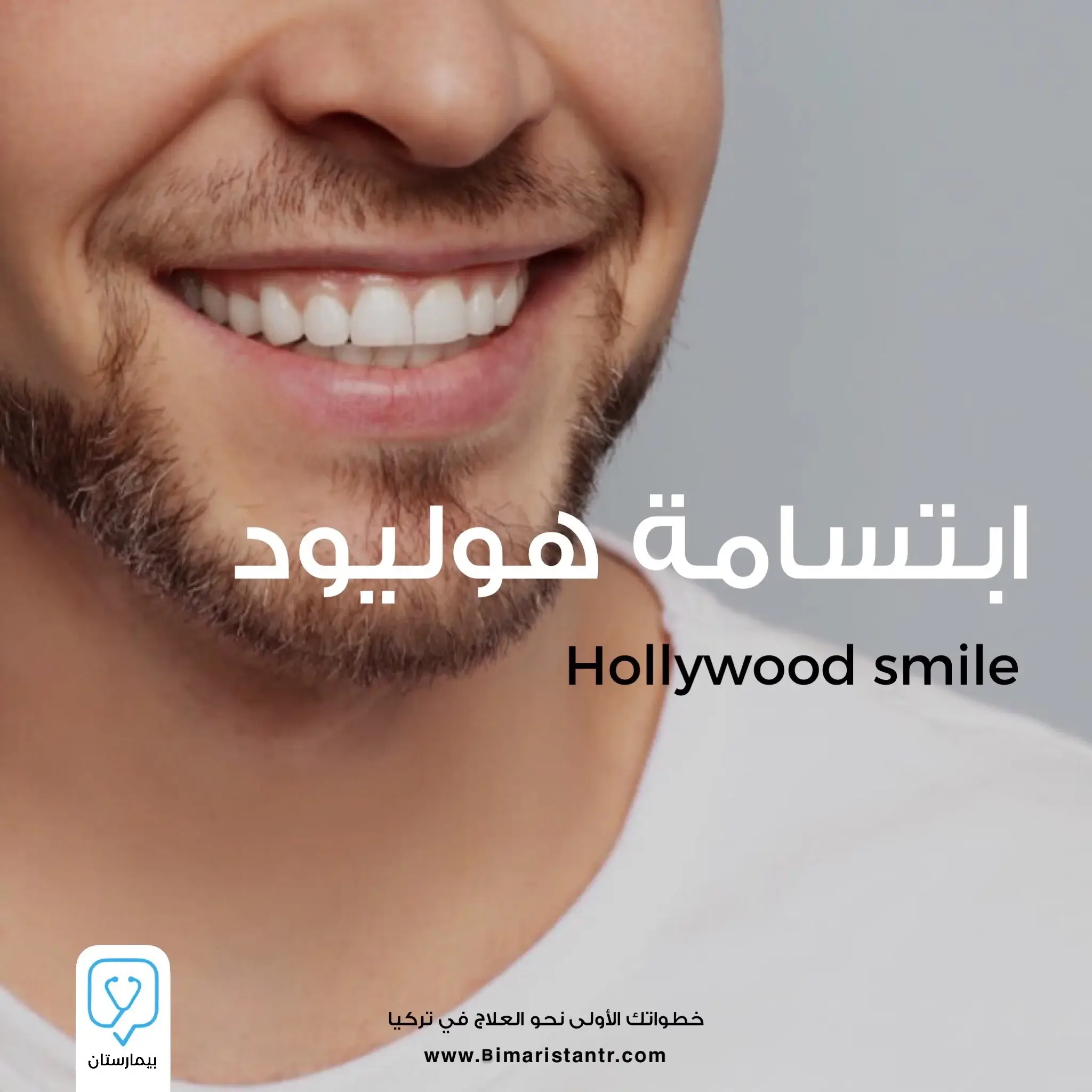 Hollywood-smile