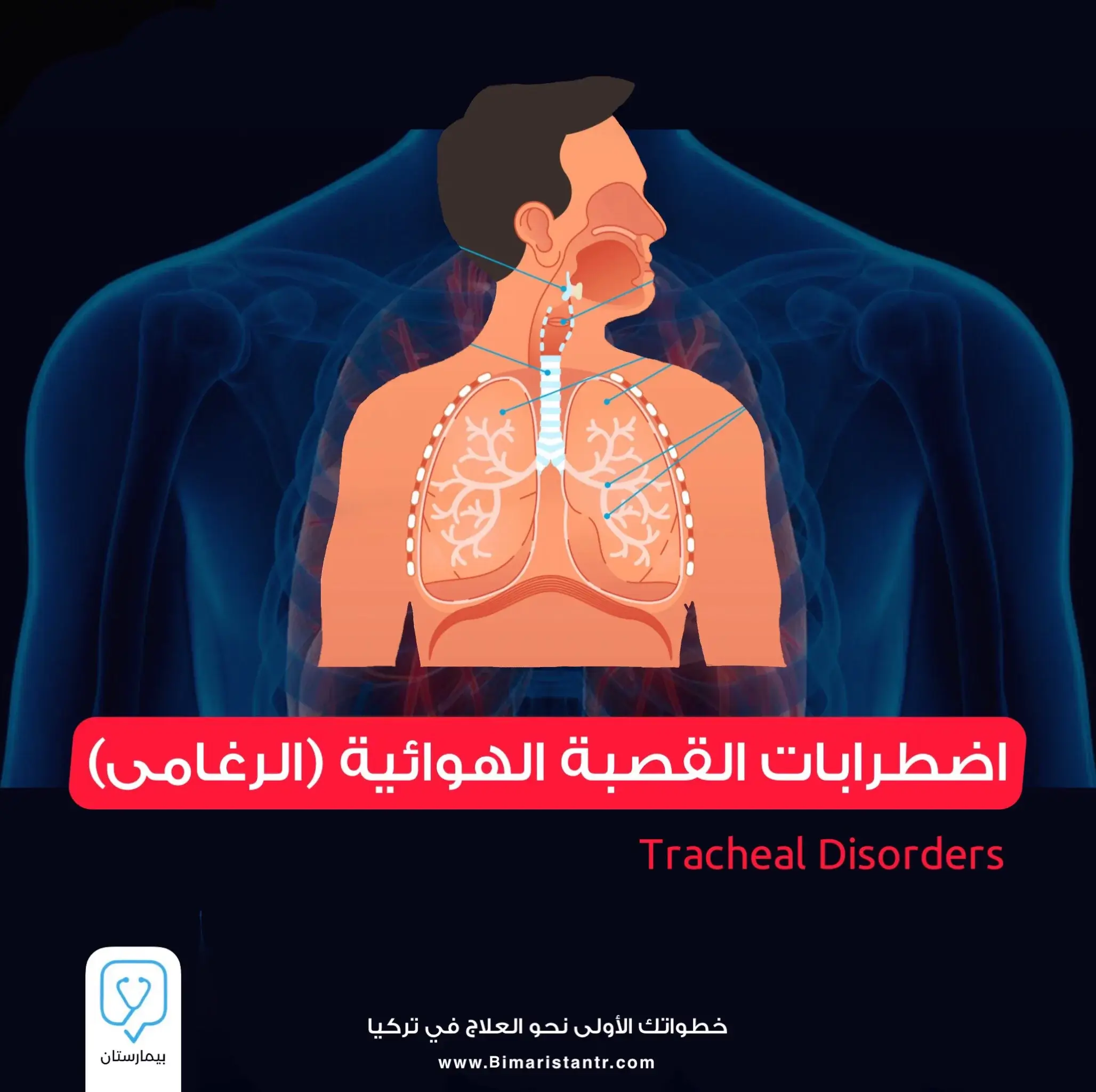 Tracheal (tracheal) disorders
