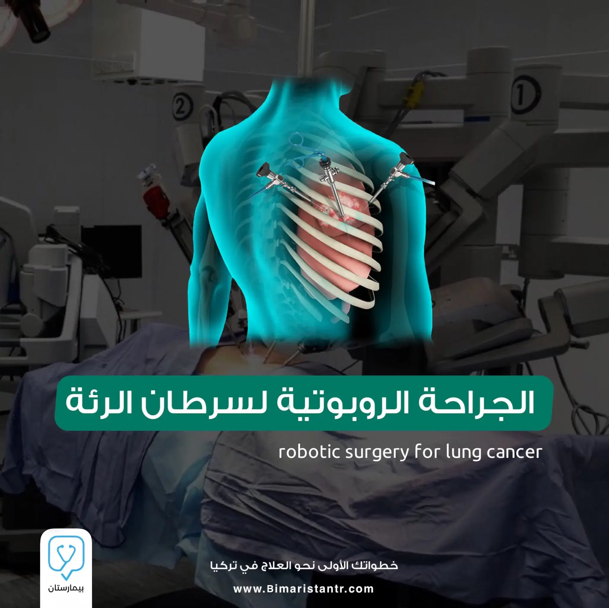 Türkiye'de akciğer kanserine robotik cerrahi