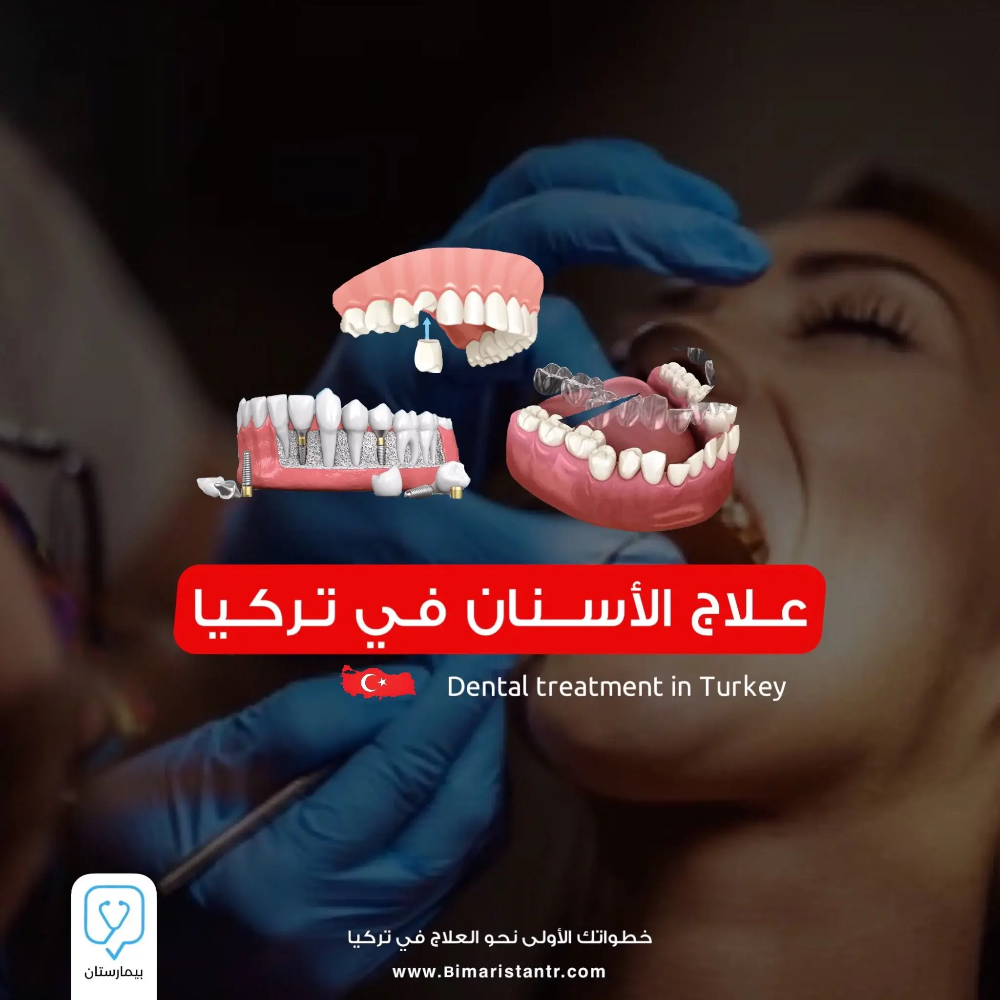 علاج-الأسنان-في-تركيا