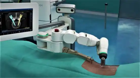 اجراء عملية جراحية باستخدام الروبوت
