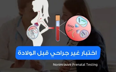 اختبار ماقبل الولادة غير الجراحي- كل ماتريد معرفته عن  الاختبار غير الجراحي قبل الولادة