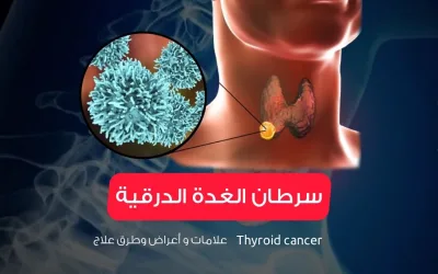 Thyroid cancer - signs, symptoms and treatment methods