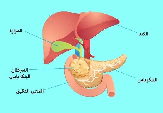 A picture showing the location of the pancreas in the digestive system and the body