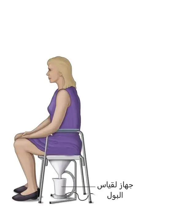 اختبارات ديناميكية البول