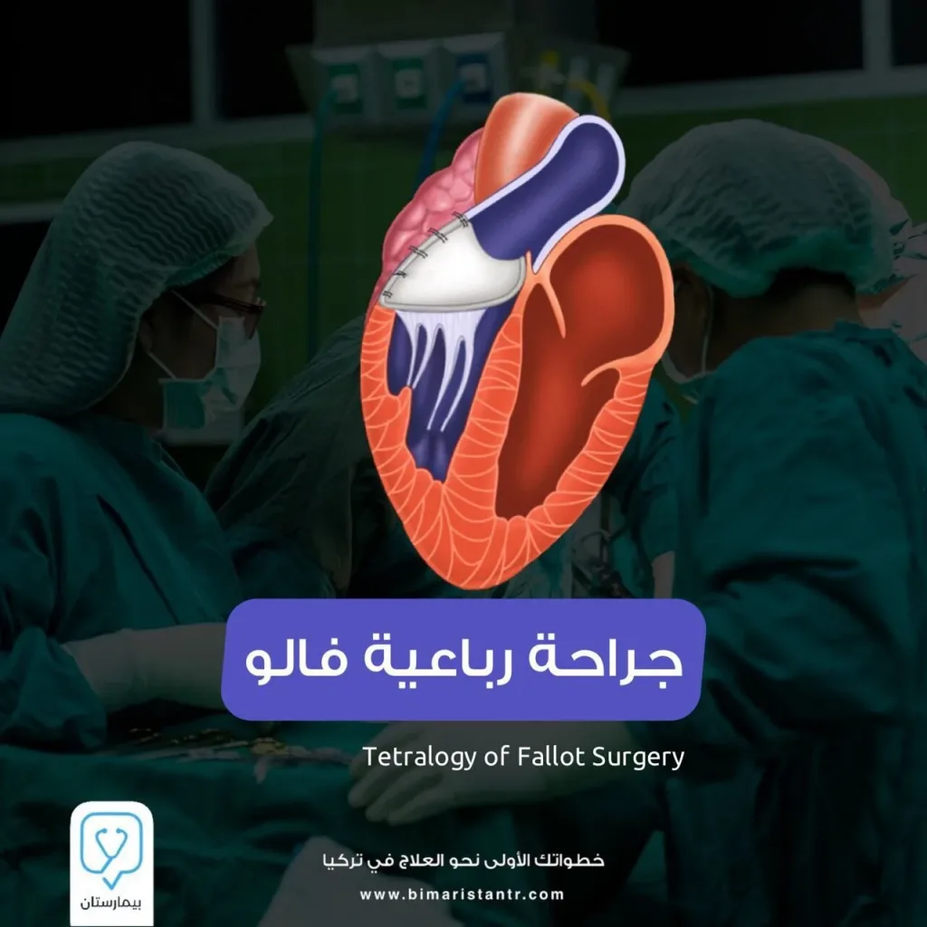Tetralogy of Fallot surgery in Turkey