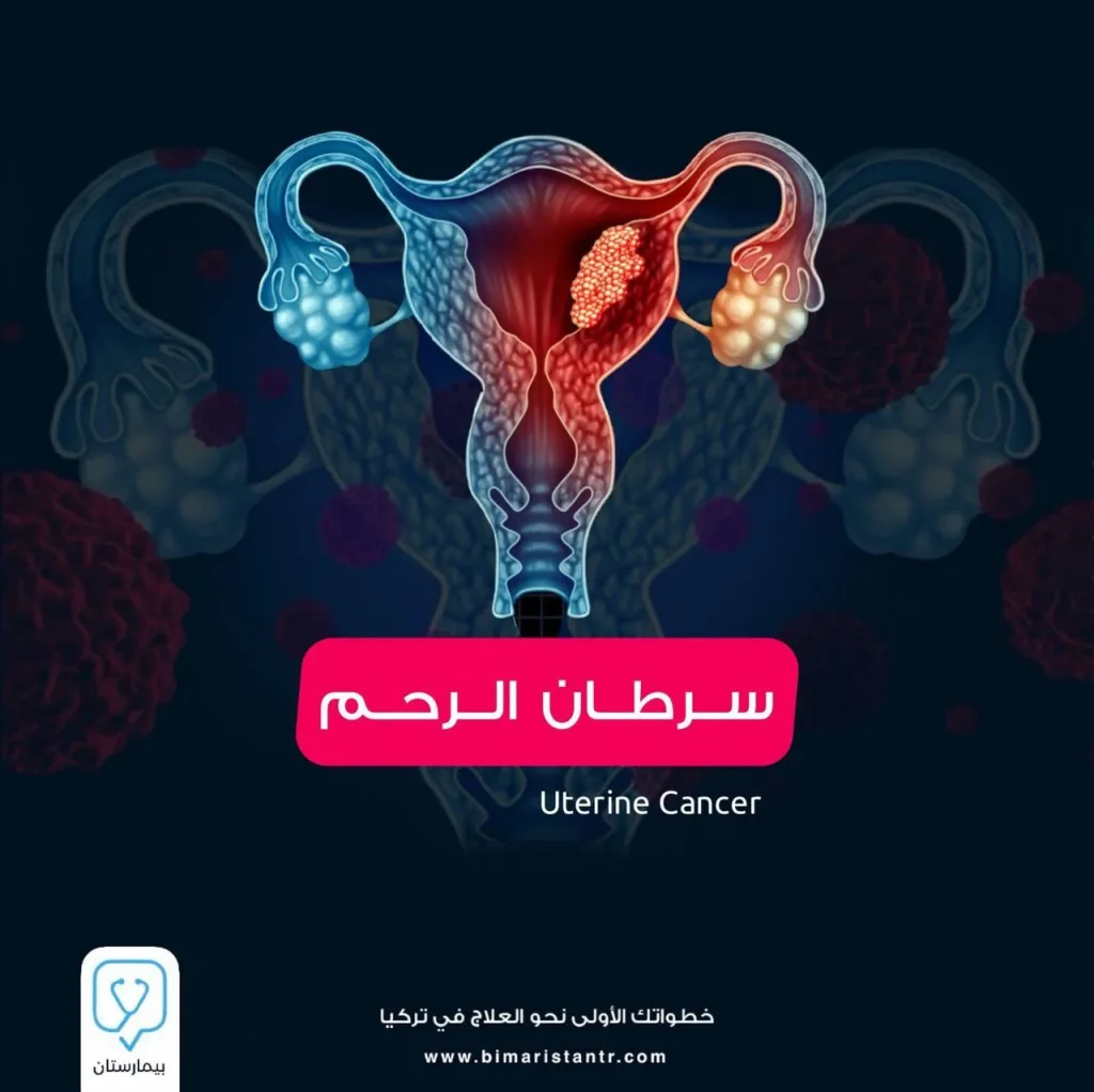 سرطان الرحم