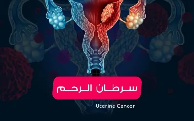 سرطان الرحم_uterine cancer_ الأعراض والعلاج لسرطان بطانة الرحم