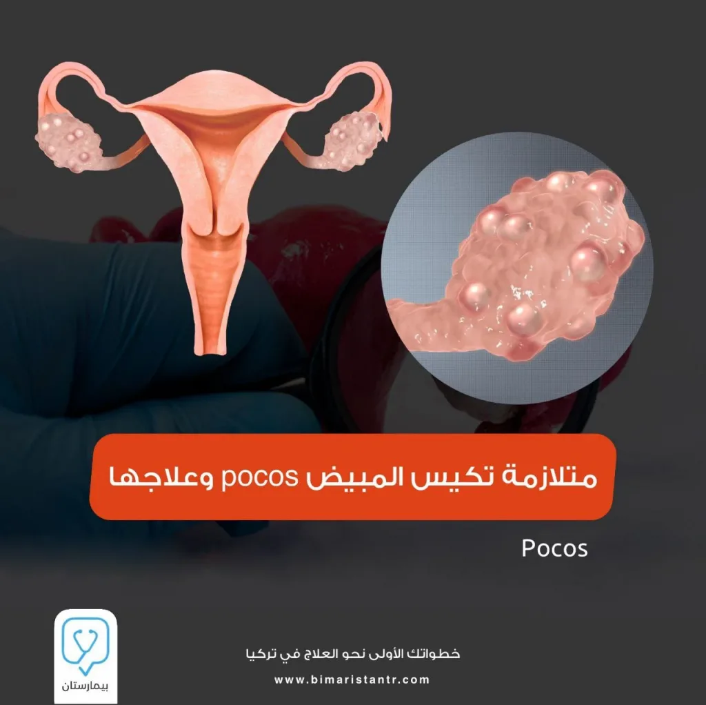 Polycystic ovary syndrome and its treatment