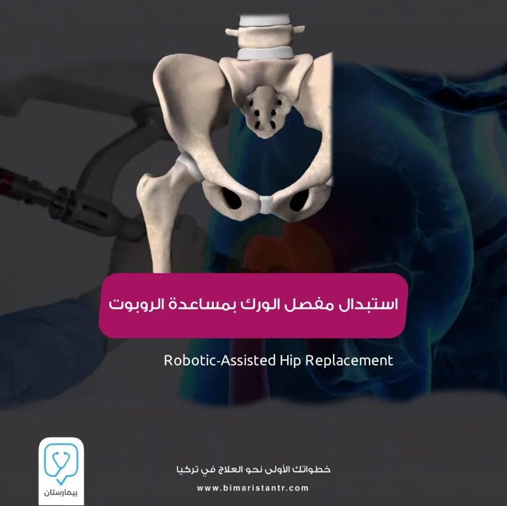 Robot-assisted hip joint replacement