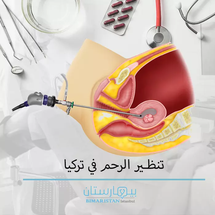 Hysteroscopy-Operation