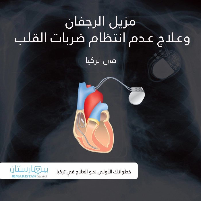 Defibrillator-and-treatment-irregular-heart-beats-in-Turkey