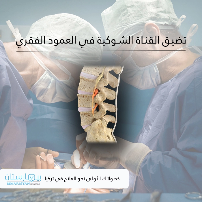 Spinal canal stenosis in the spinal column