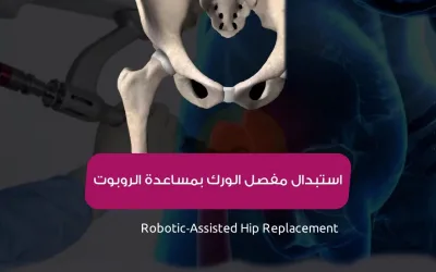 Robotic hip replacement surgery