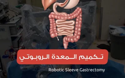 Robotic obesity surgery