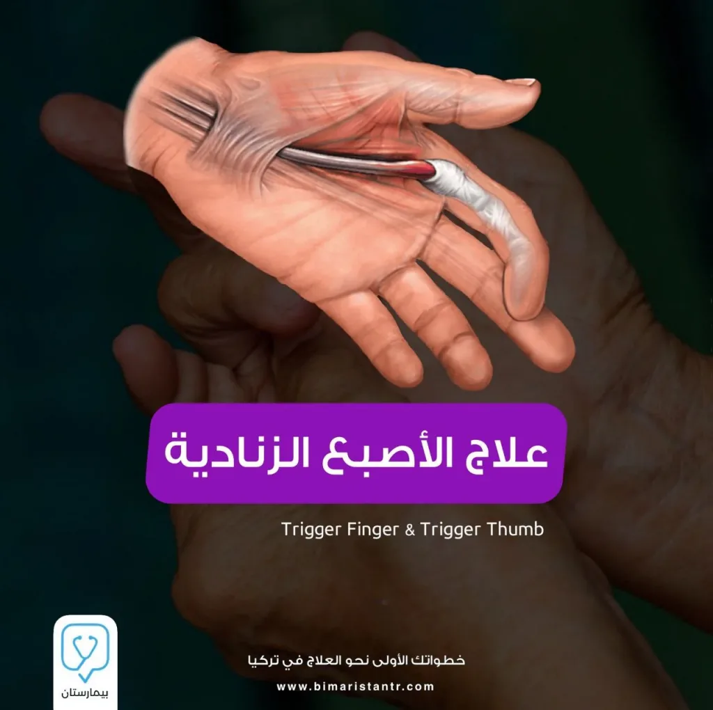 Trigger finger treatment in Turkey