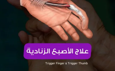علاج الإصبع الزنادي