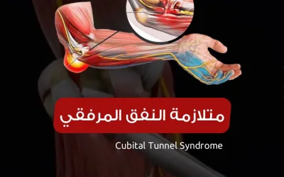 Ulnar nerve entrapment treatment
