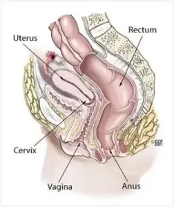 تشريح الحوض الأنثوي، يظهر موقع المهبل (Vagina) بالنسبة للجسم