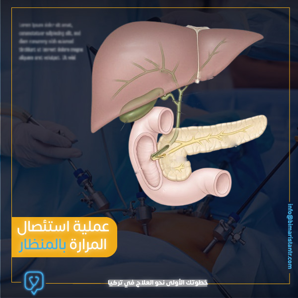laparoscopic-laparoscopic-resection of the gallbladder