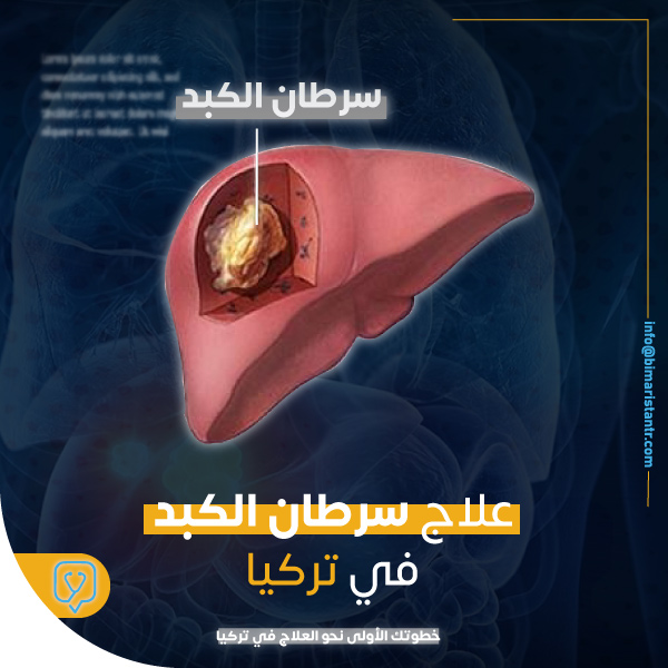 Liver cancer treatment in Turkey