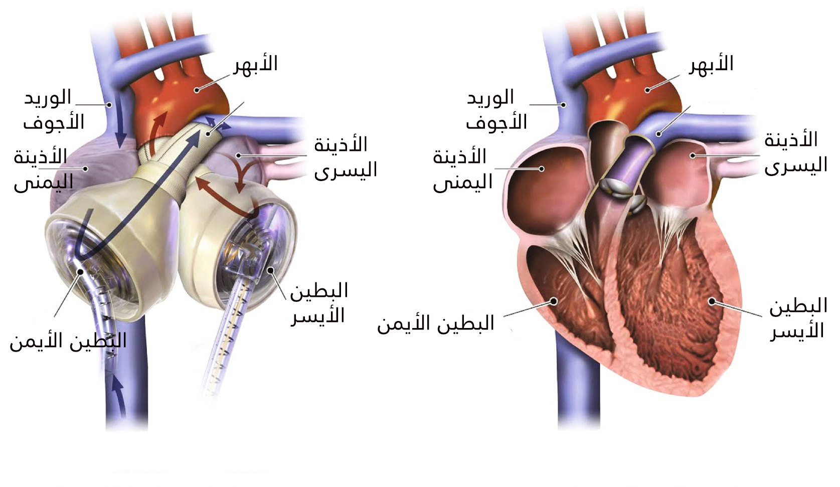 يحتوي القلب الصناعي على حجرتين تقابلان البطينين الأيمن والأيسر
