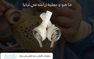 The artificial heart: what is it and the process of its implantation in Turkey