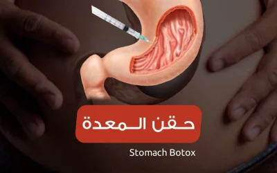 gastric botox needle