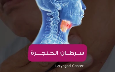 Malignant laryngeal cancer