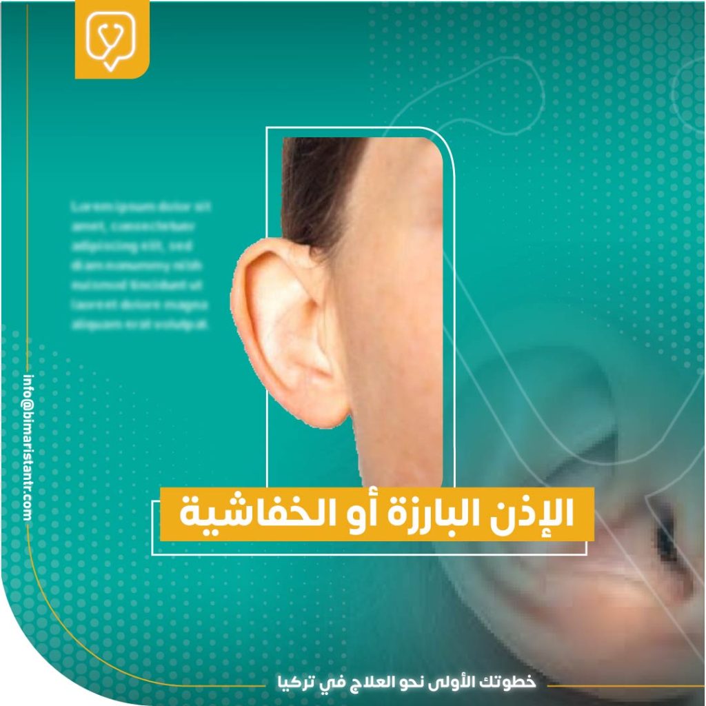 علاج الأذن الخفاشية بدون جراحة - تجميل الأذن البارزة