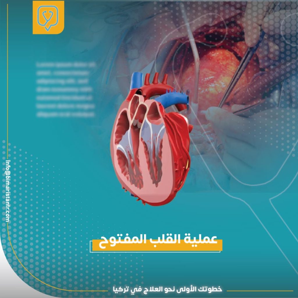 Open heart surgery in Turkey