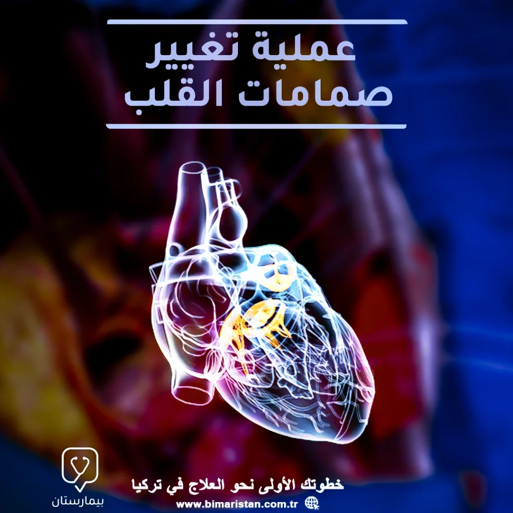 عملية تغيير صمامات القلب في تركيا